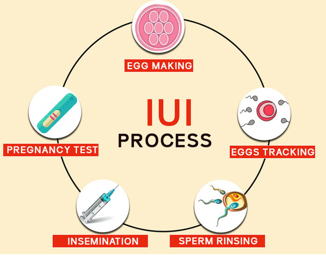 IUI Treatment