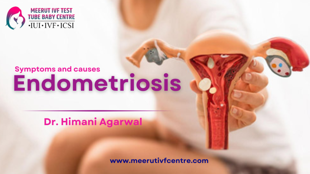 Endometriosis - Symptoms and causes