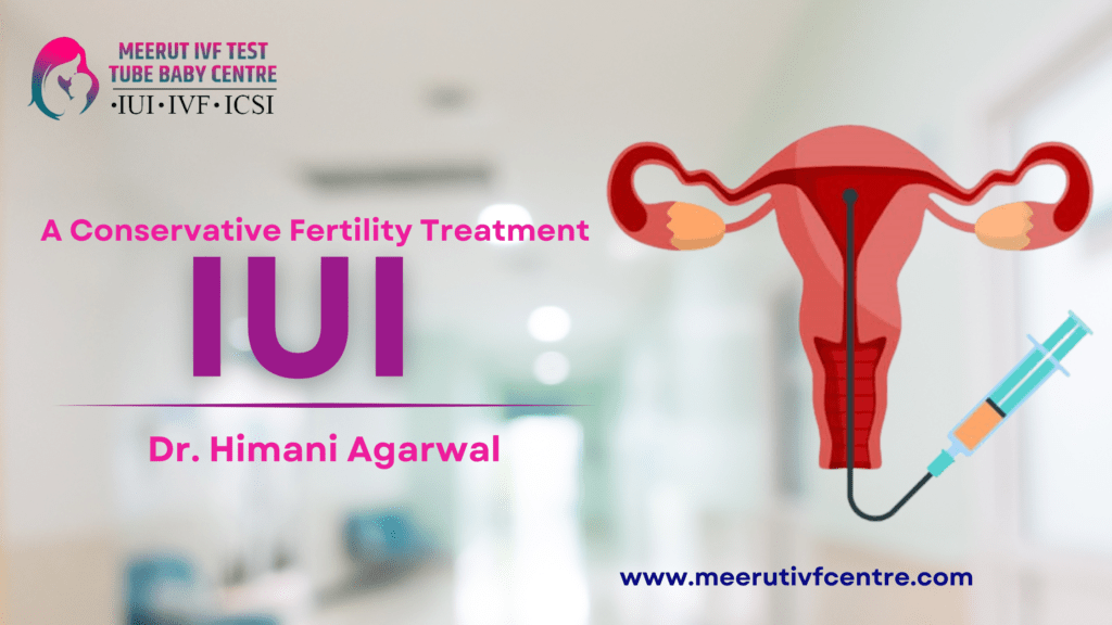 IUI A Conservative Fertility Treatment